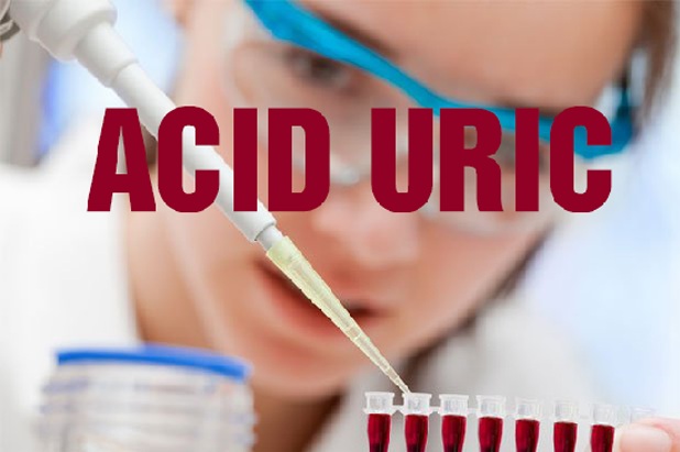 Giảm acid uric